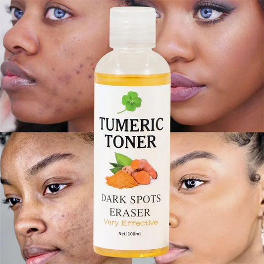 Turmeric Whitening Face Toner Effective Remove Dark Spots