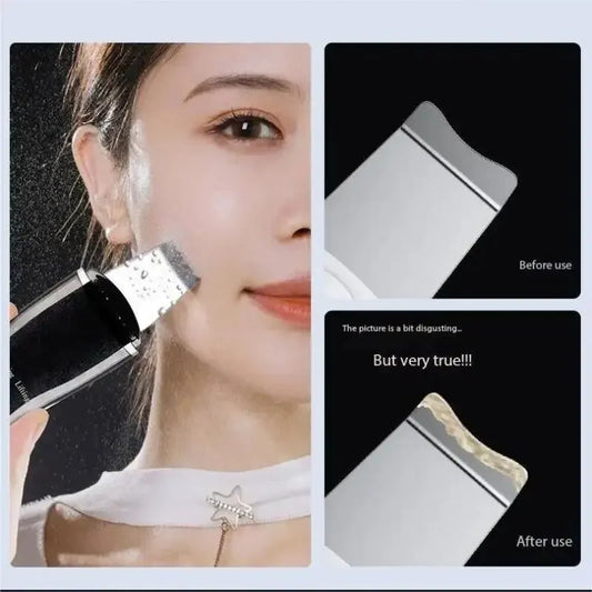 Blackhead Remover Blackhead Cleaning Pore Shrinking Beauty Device Dead
